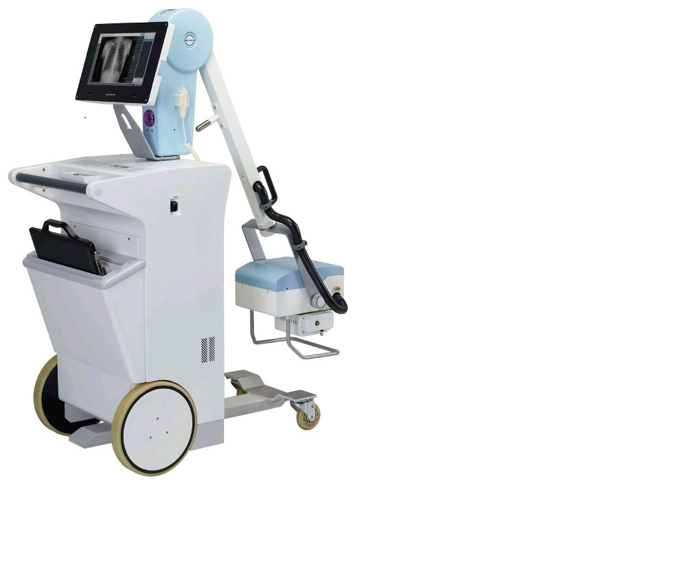 mobile xray updated image