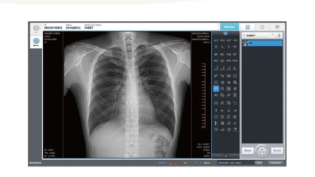 xray portable test